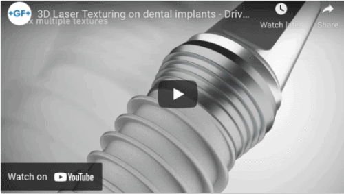 3D Laser Texturing on dental implants - Drive innovation with functional surfaces